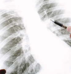 レントゲン写真